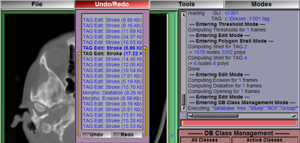 Undo / Redo